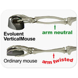 Difference in arm bones between vertical mouse and regular mouse